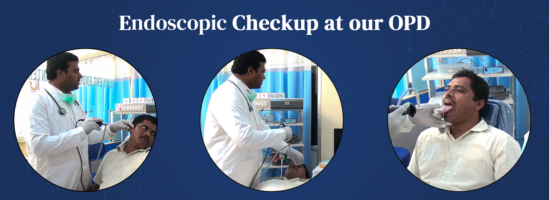 Endoscopic ENT checkup in OPD